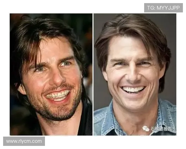 足球明星整牙背后的故事与改变人生的微笑之旅